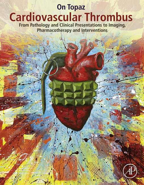 Cardiovascular Thrombus main product photo