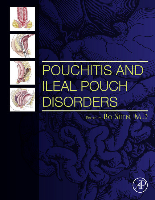 Pouchitis and Ileal Pouch Disorders main product photo