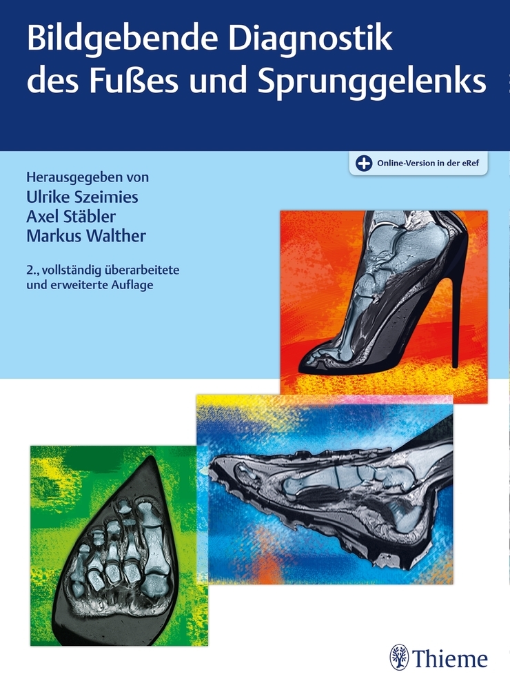 Bildgebende Diagnostik des Fußes und Sprunggelenks main product photo