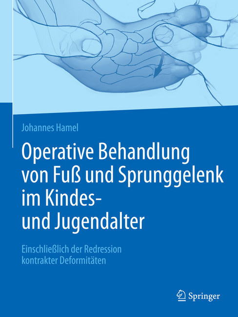 Operative Behandlung von Fuß und Sprunggelenk im Kindes- und Jugendalter main product photo