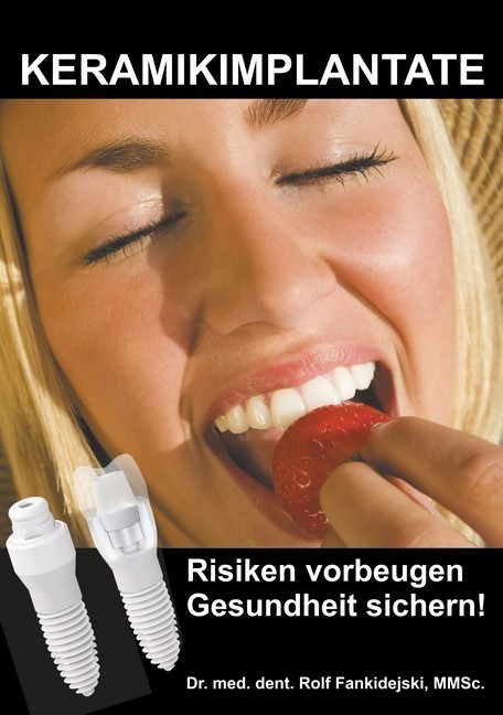 Keramikimplantate main product photo