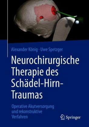 Neurochirurgische Therapie des Schädel-Hirn-Traumas