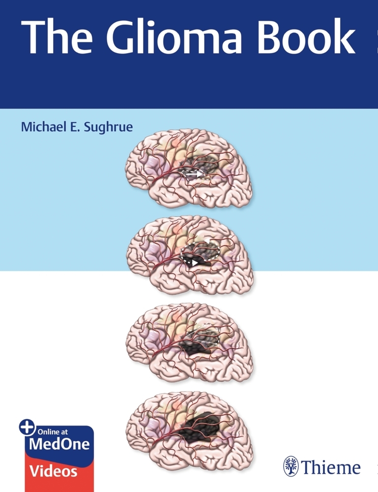 The Glioma Book main product photo