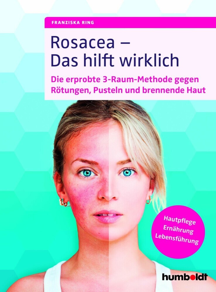 Rosacea - Das hilft wirklich main product photo