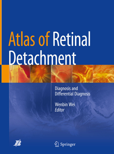 Atlas of Retinal Detachment main product photo
