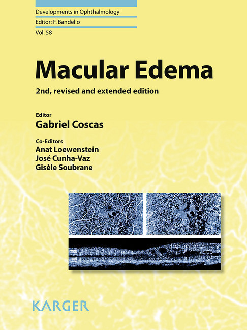Macular Edema main product photo