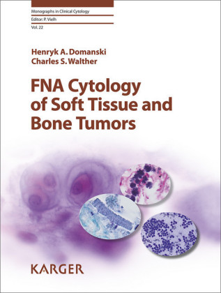 FNA Cytology of Soft Tissue and Bone Tumors