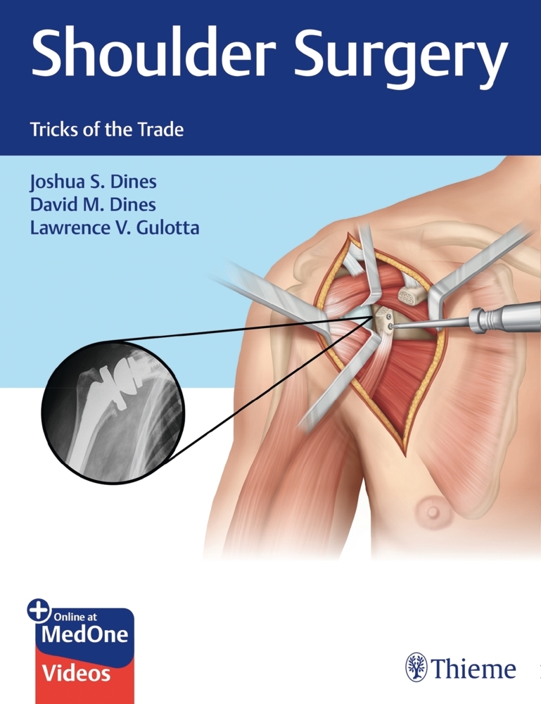 Shoulder Surgery main product photo