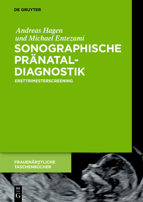 Sonographische Pränataldiagnostik main product photo
