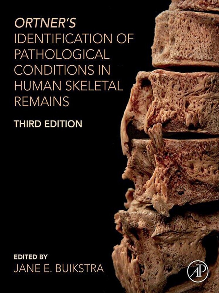 Ortner's Identification of Pathological Conditions in Human Skeletal Remains main product photo