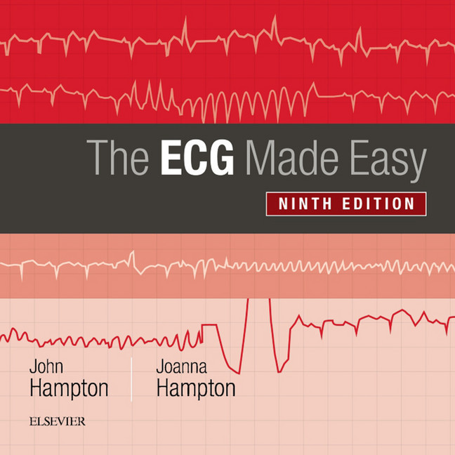 The ECG Made Easy E-Book main product photo