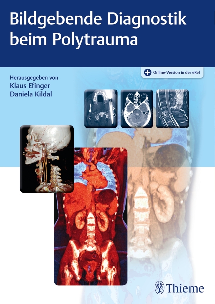 Bildgebende Diagnostik beim Polytrauma main product photo