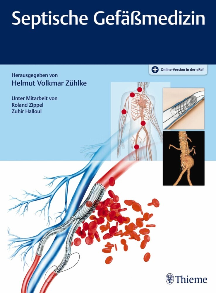 Septische Gefäßmedizin main product photo