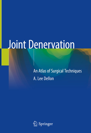 Joint Denervation main product photo