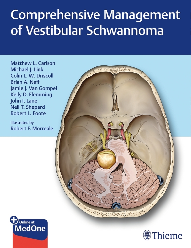 Comprehensive Management of Vestibular Schwannoma main product photo