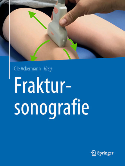 Fraktursonografie main product photo
