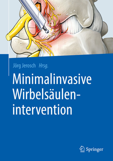 Minimalinvasive Wirbelsäulenintervention main product photo