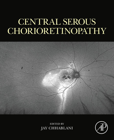 Central Serous Chorioretinopathy main product photo