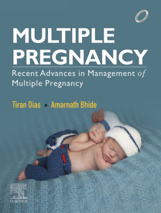 Multiple Pregnancy- E-book