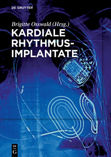 Kardiale Rhythmusimplantate main product photo