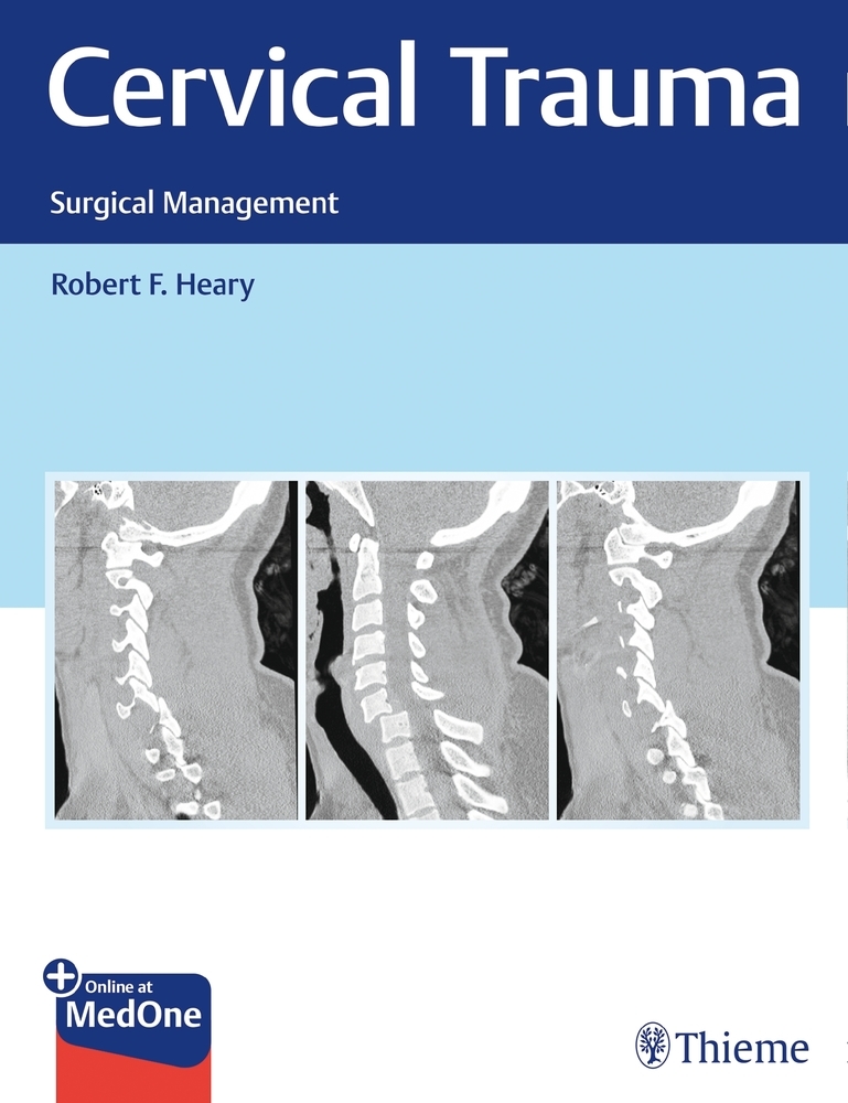 Cervical Trauma main product photo