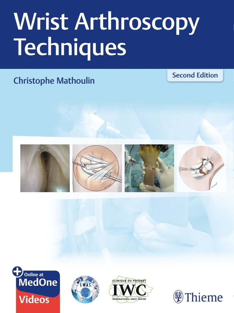 Wrist Arthroscopy Techniques main product photo
