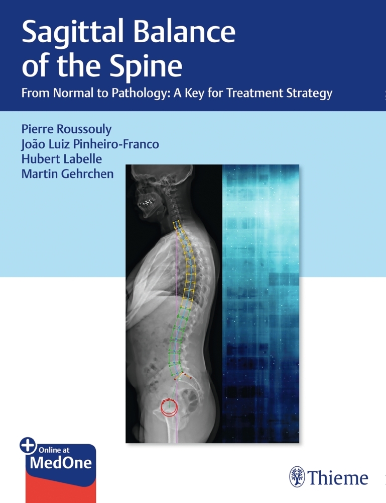Sagittal Balance of the Spine main product photo