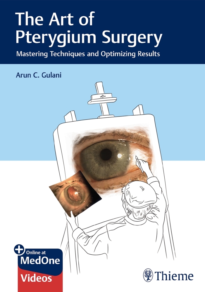 The Art of Pterygium Surgery main product photo
