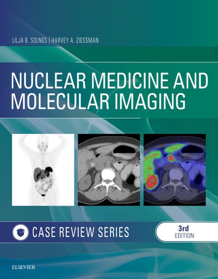 Nuclear Medicine and Molecular Imaging: Case Review Series E-Book main product photo