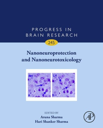 Nanoneuroprotection and Nanoneurotoxicology