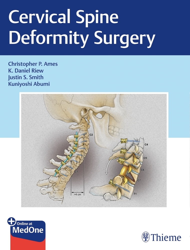 Cervical Spine Deformity Surgery main product photo