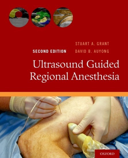 Ultrasound Guided Regional Anesthesia main product photo