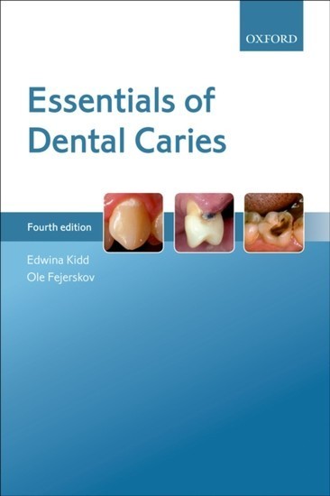 Essentials of Dental Caries main product photo