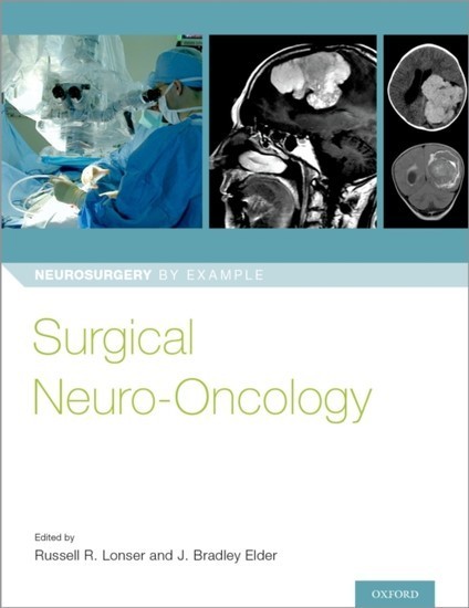 Surgical Neuro-Oncology main product photo