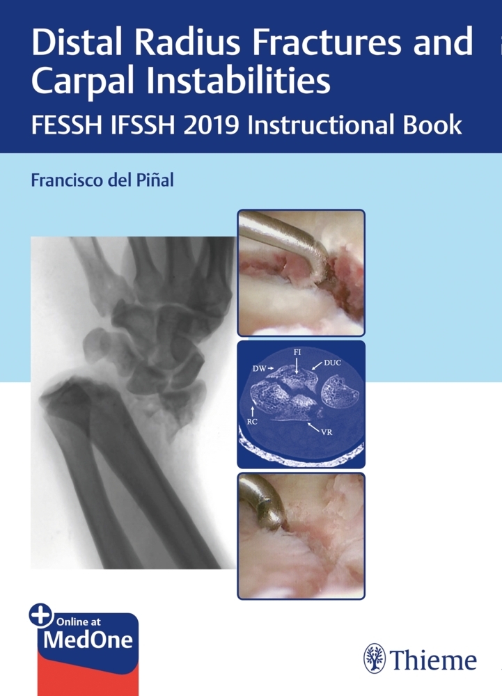 Distal Radius Fractures and Carpal Instabilities main product photo