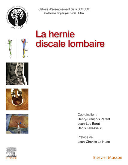 La hernie discale lombaire main product photo