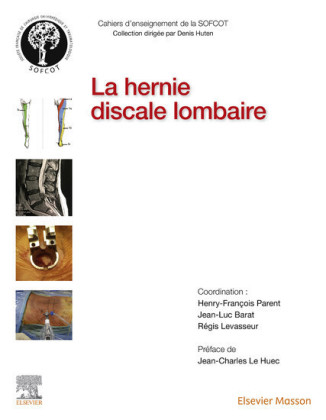 La hernie discale lombaire