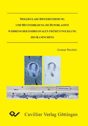 Molekulare Differenzierung und Musterbildung im Hypoblasten w&#xE4;hrend der embryonalen Fr&#xFC;hentwicklung des Kaninchens