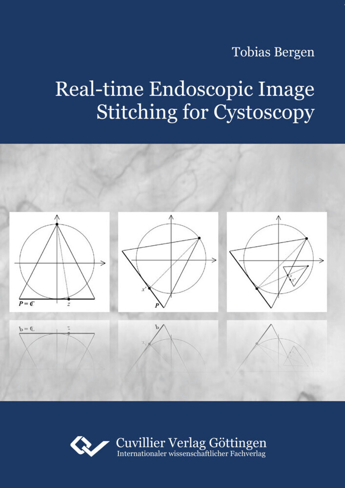 Real-time Endoscopic Image Stitching for Cystoscopy main product photo