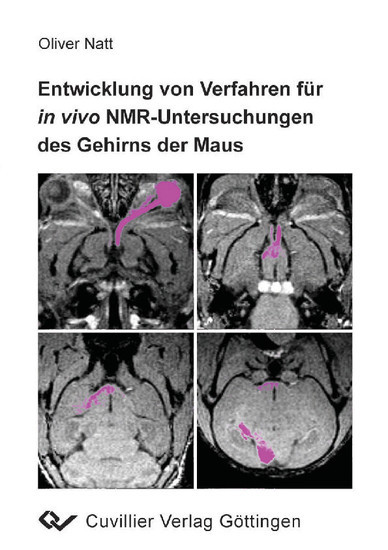 Entwicklung von Verfahren für in vivo NMR-Untersuchungen des Gehirns der Maus main product photo