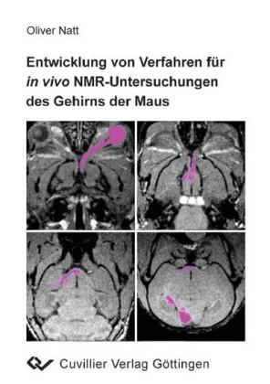 Entwicklung von Verfahren f&#xFC;r in vivo NMR-Untersuchungen des Gehirns der Maus