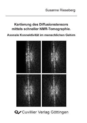 Kartierung des Diffusionstensors mittels schneller NMR-Tomographie. Axonale Konnektivit&#xE4;t im menschlichen Gehirn