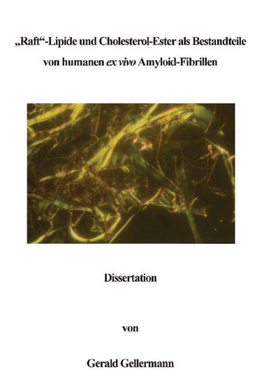 Raft -Lipide und Cholesterol-Ester als Bestandteile von humanen ex vivo Amyloid-Fibrillen main product photo