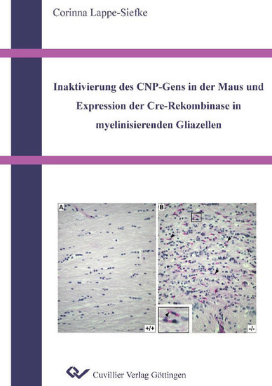 Inaktivierung des CNP-Gens in der Maus und Expression der Cre-Rekombinase in myelinisierenden Gliazellen main product photo