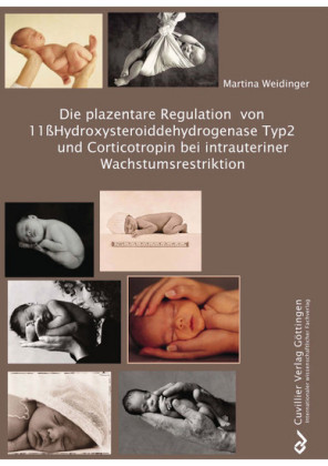 Die plazentare Regulation von 11&#xDF;Hydroxysteroiddehydrogenase Typ2 und Corticotropin bei intrauteriner Wachstumsrestriktion