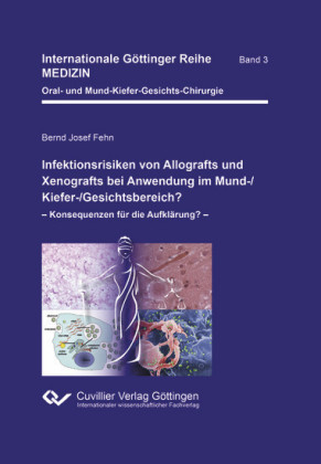 Infektionsrisiken von Allografts und Xenografts bei Anwendung im Mund-/Kiefer-/Gesichtsbereich?