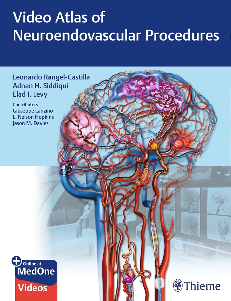 Video Atlas of Neuroendovascular Procedures main product photo