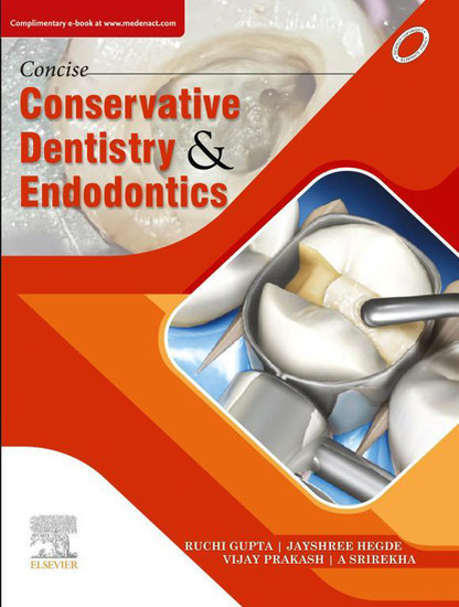 Concise Conservative Dentistry and Endodontics- E Book main product photo