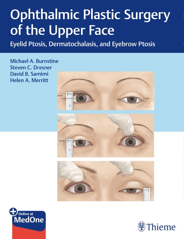 Ophthalmic Plastic Surgery of the Upper Face main product photo
