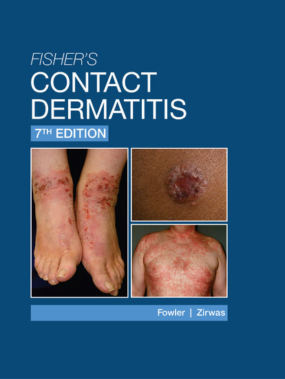 Fisher's Contact Dermatitis - 7th Edition main product photo